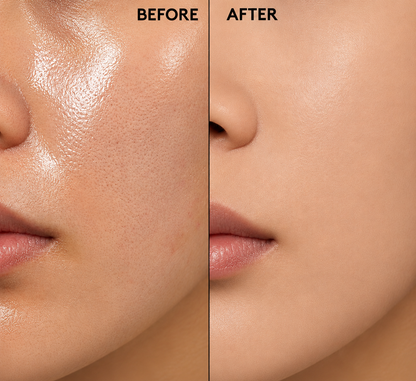 Zorivela® OIL-SUCKER SPRAY