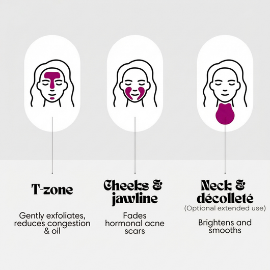 ✨Zorivela® Cream | Correct blemishes, dark spots and uneven skin tone