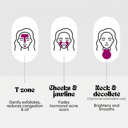 ✨Zorivela® Cream | Correct blemishes, dark spots and uneven skin tone
